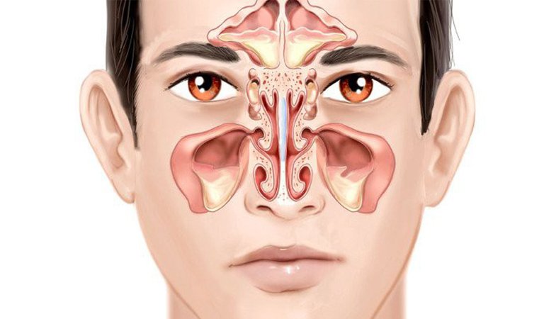 tắm nước ấm giúp giảm viêm xoang