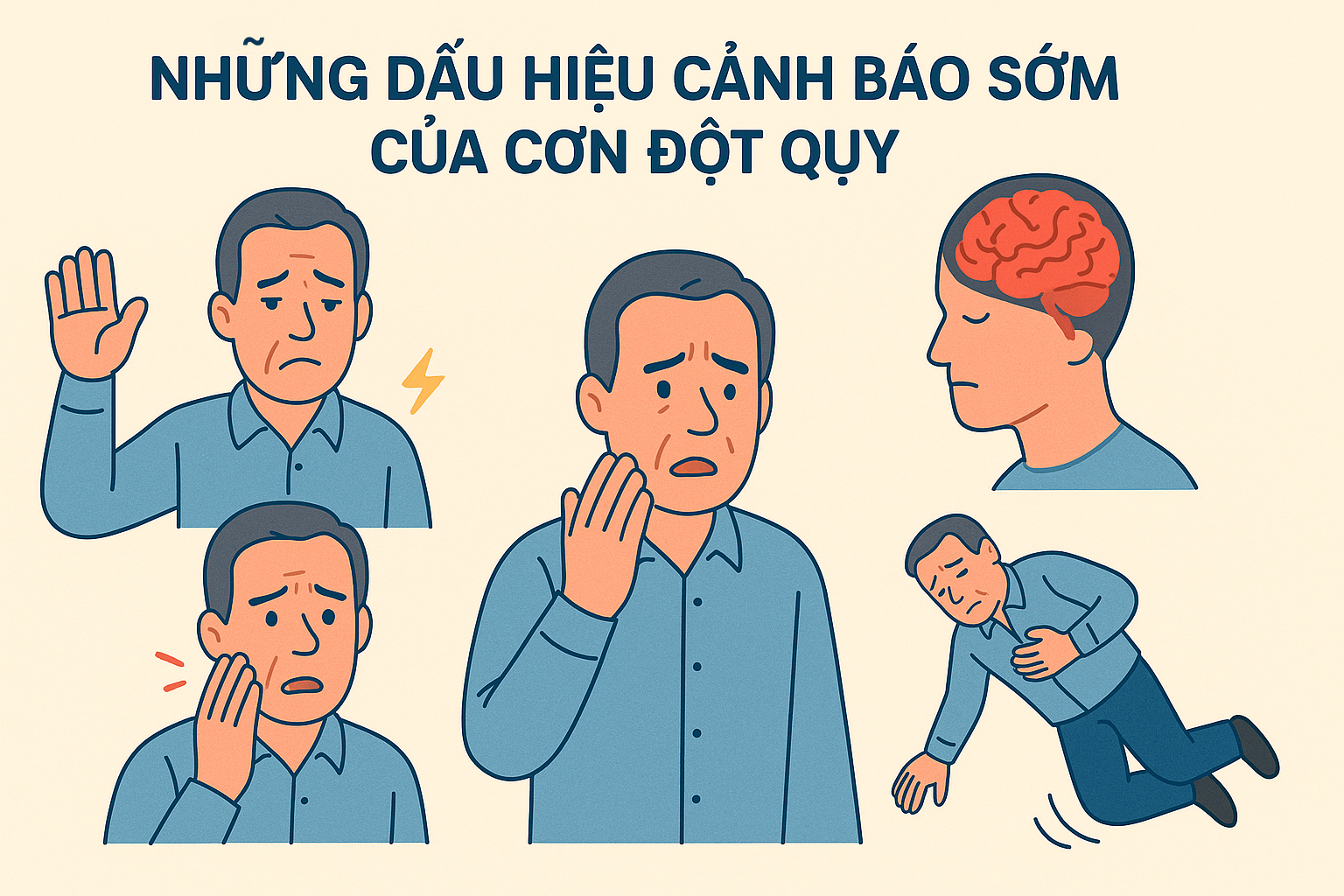 nhiều dấu hiệu cảnh báo đột quỵ