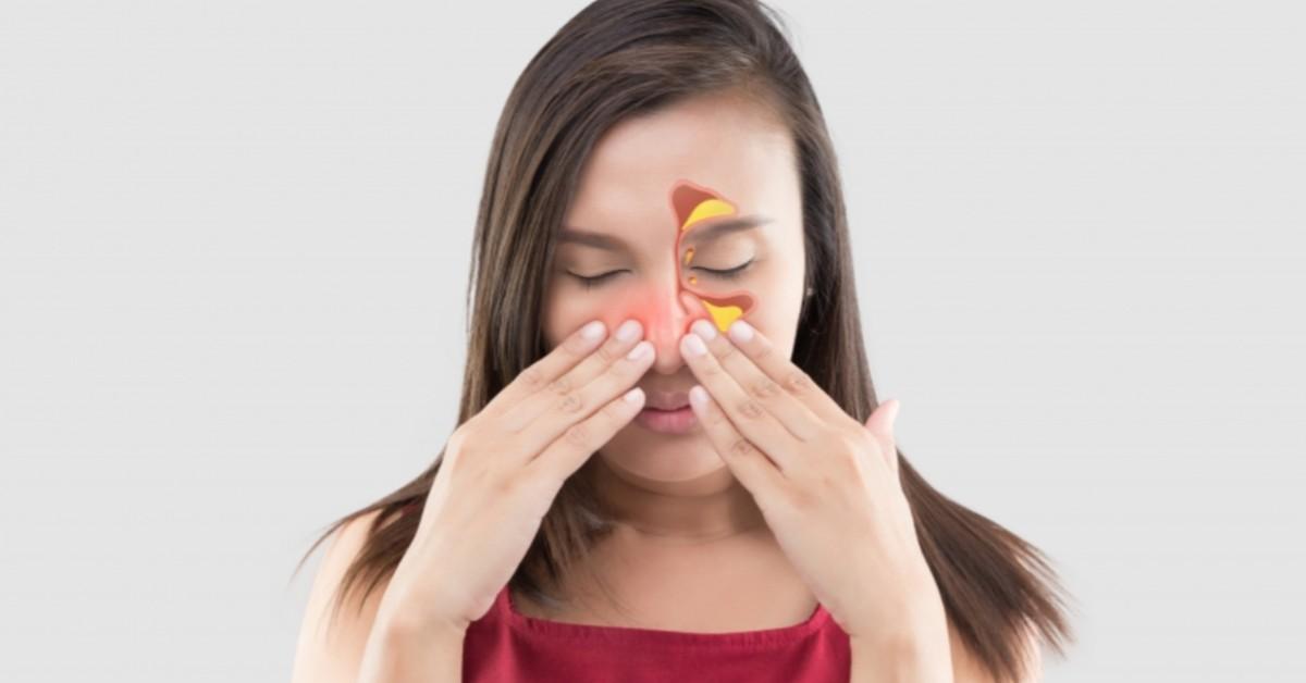 Viêm xoang có thể gây nhức đầu và cảm giác nặng mặt do niêm mạc xoang bị phù nề